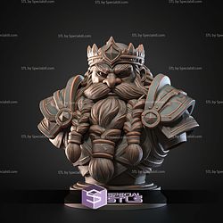 Mini Fantasy STL Collection Dwarf King Bust 3D Model